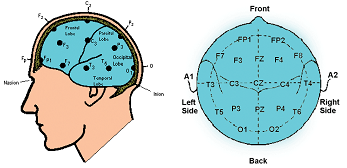 Illustration for article titled Endurance Athletes May Soon Be Electrocuting Their Brains